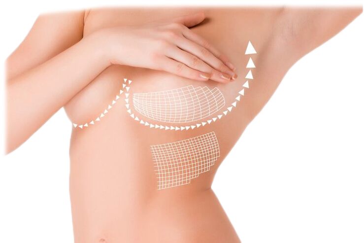 Action of Mammax capsules for breast enlargement