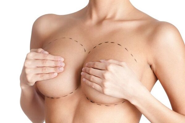 appointment for breast augmentation surgery